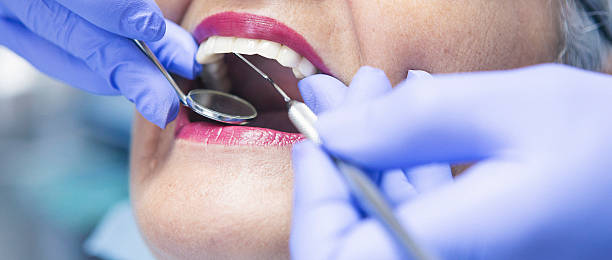 Best Knocked-Out Tooth Emergency  in Clarkesville, GA
